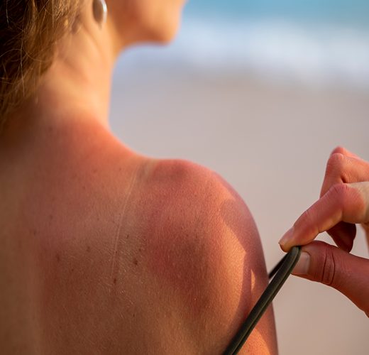 SAFEGUARDING YOUR SKIN: POLLUTION, UV DAMAGE, AND EXPERT ADVICE