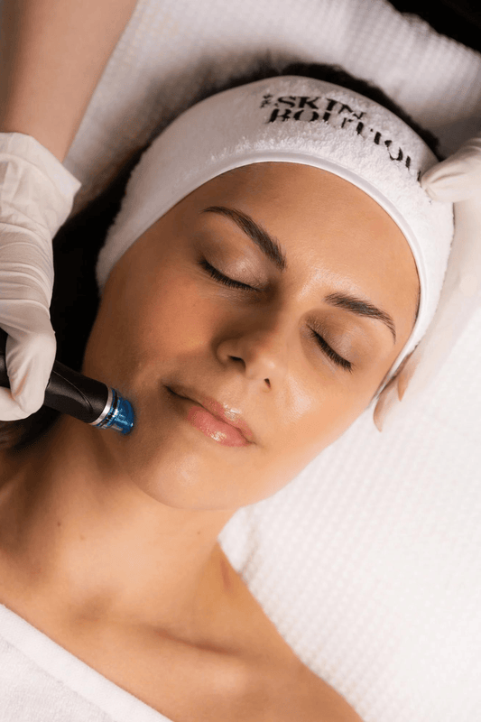Face Pigmentation : ND Yag Laser , Erbium Glass Laser & Mesotherapy - Dr Anvika